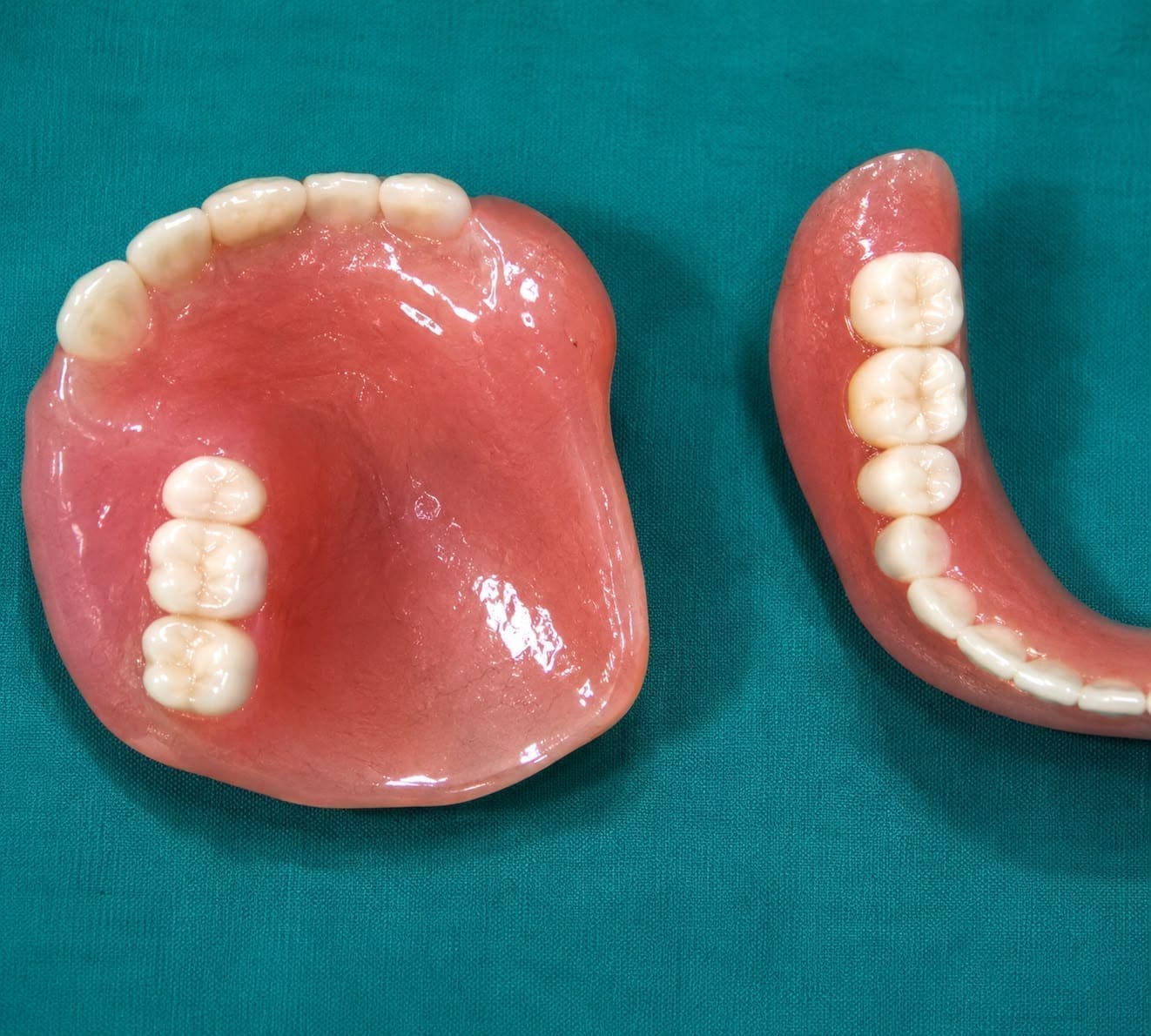 Patient after custom maxillofacial prosthesis by Dr. Ritu Saneja