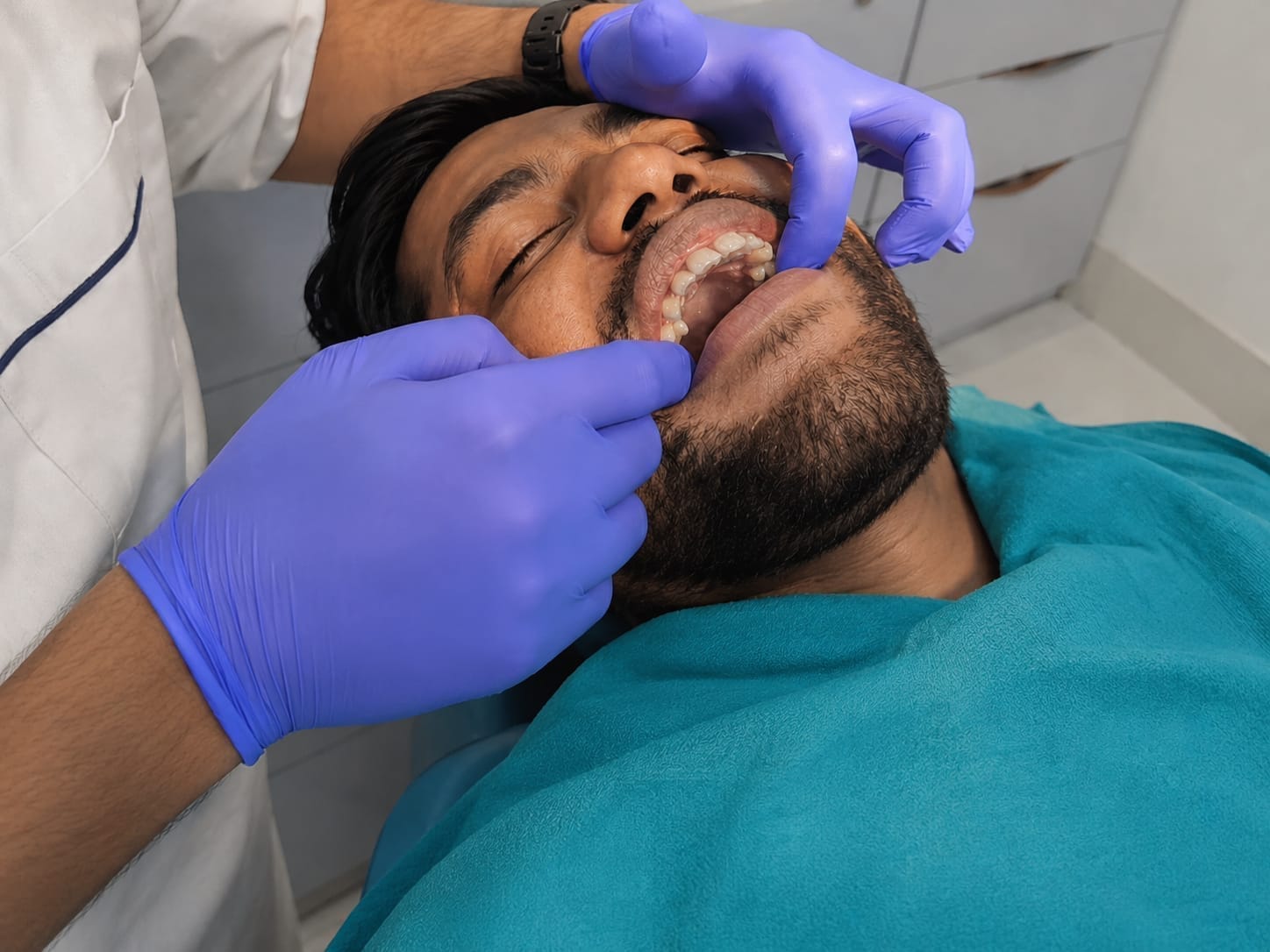 Clear aligners orthodontic treatment result at The DentalBrace Clinic Bathinda — patient Piyush showing straight teeth after clear aligner therapy by Dr. Sandeep Kumar MDS Orthodontist, best Invisalign provider in Bathinda Punjab India